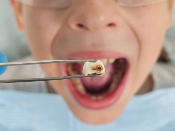 Best Broken Tooth Emergency  in Louisa, KY