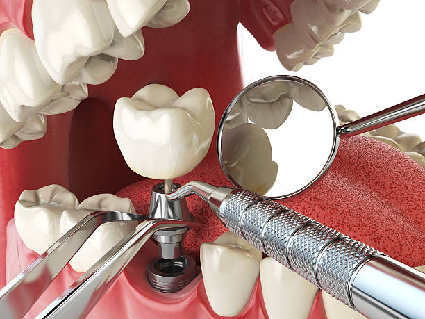 Best Cracked Tooth Emergency Dentist  in Louisa, KY